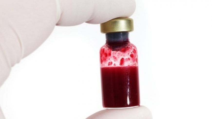Blood Values for Raw Fed Dogs vs Kibble Fed Dogs